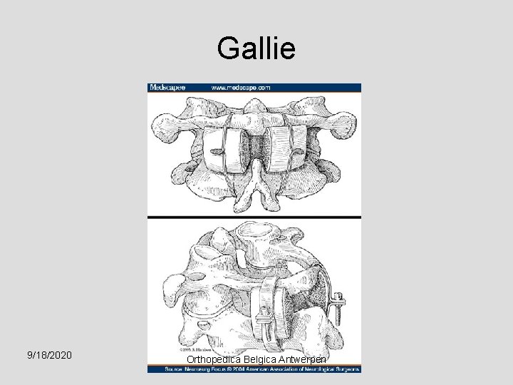 Gallie 9/18/2020 Orthopedica Belgica Antwerpen 