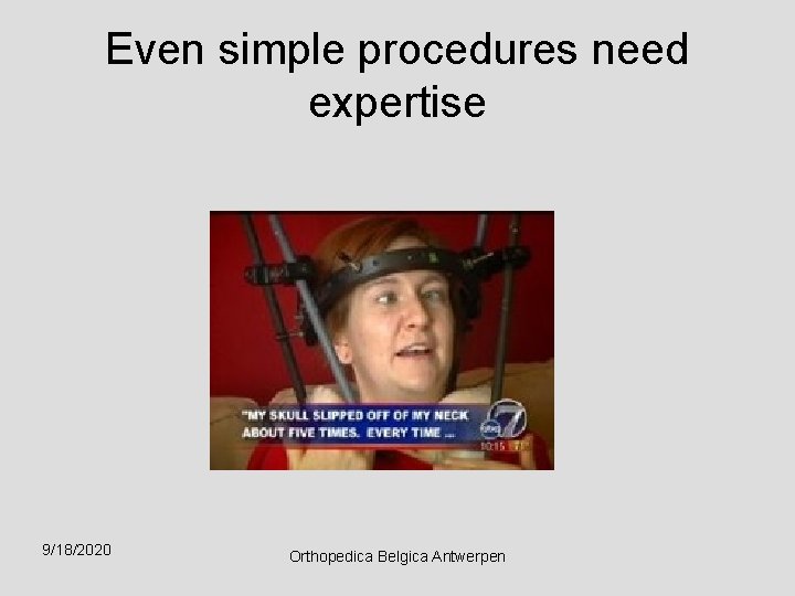 Even simple procedures need expertise 9/18/2020 Orthopedica Belgica Antwerpen 