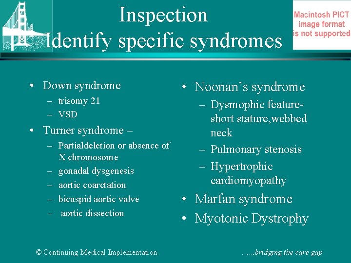 Inspection Identify specific syndromes • Down syndrome – trisomy 21 – VSD • Turner