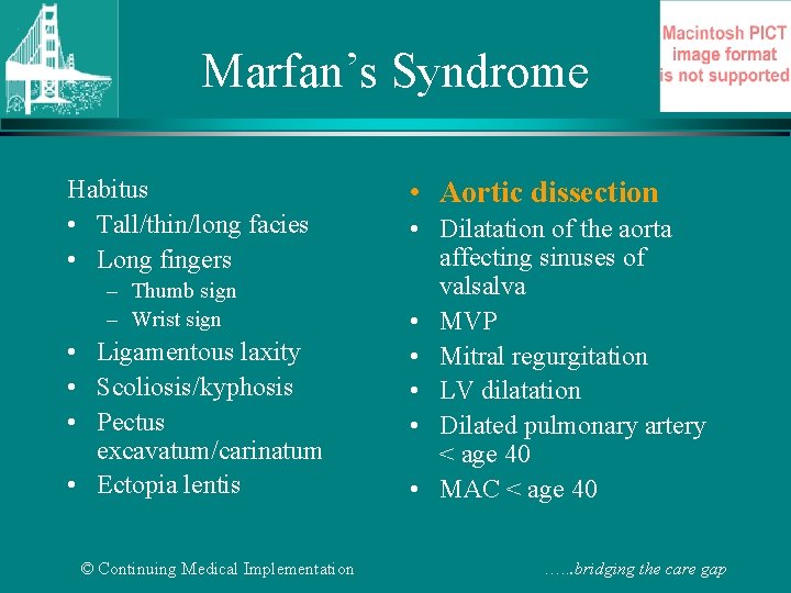 Marfan’s Syndrome Habitus • Tall/thin/long facies • Long fingers – Thumb sign – Wrist