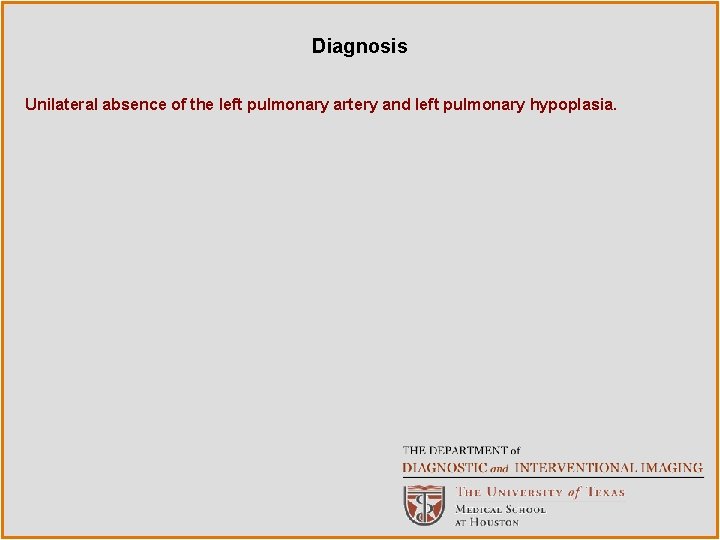 Diagnosis Unilateral absence of the left pulmonary artery and left pulmonary hypoplasia. 