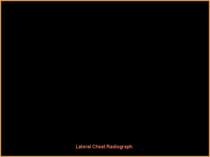 Radiological Presentations Lateral Chest Radiograph 