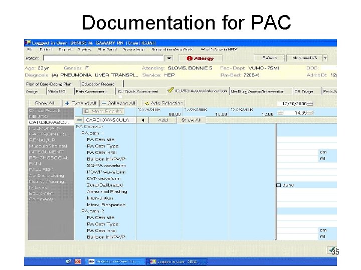 Documentation for PAC 35 