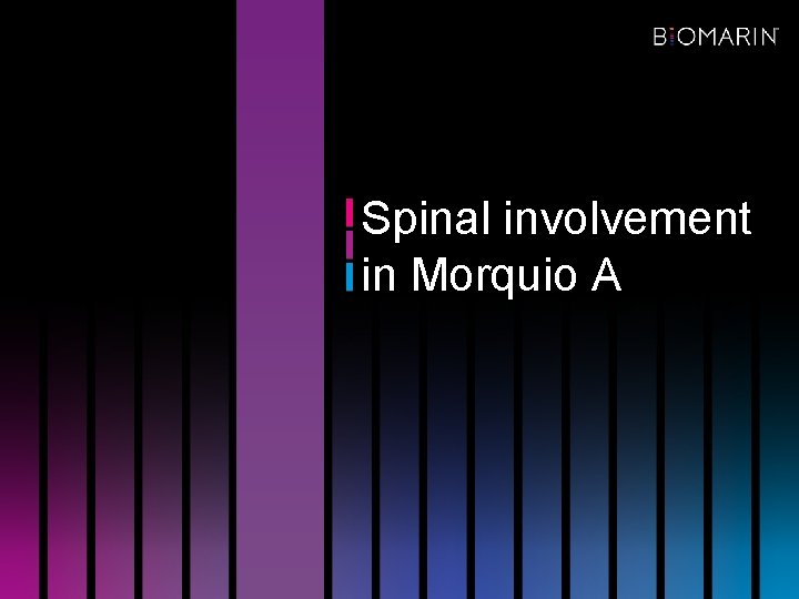 Spinal involvement in Morquio A 