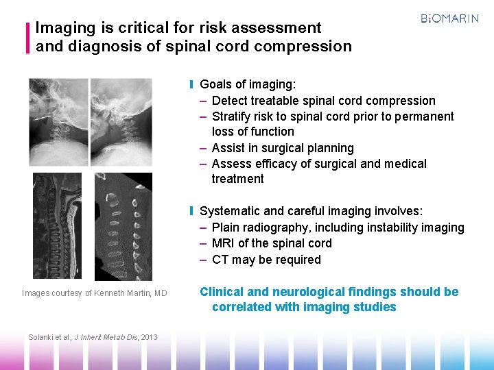 Imaging is critical for risk assessment and diagnosis of spinal cord compression Goals of