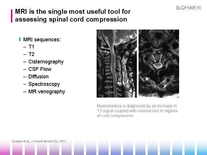 MRI is the single most useful tool for assessing spinal cord compression MRI sequences: