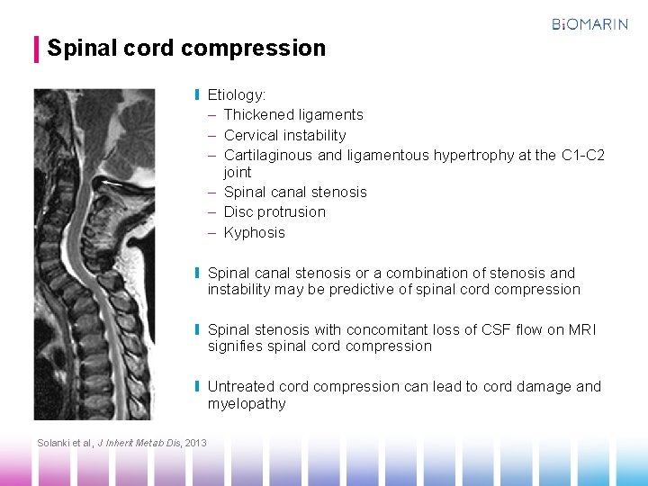 Spinal cord compression Etiology: – Thickened ligaments – Cervical instability – Cartilaginous and ligamentous