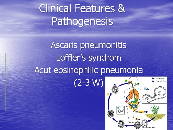 ascaris tachycardia