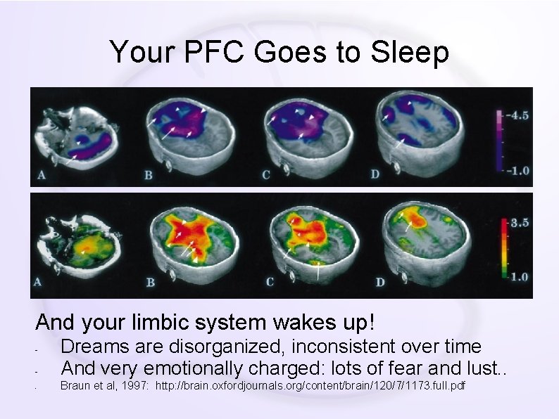 Your PFC Goes to Sleep And your limbic system wakes up! - Dreams are