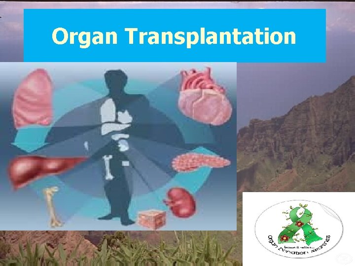 Organ Transplantation 