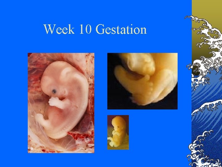 Week 10 Gestation 