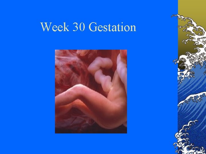 Week 30 Gestation 