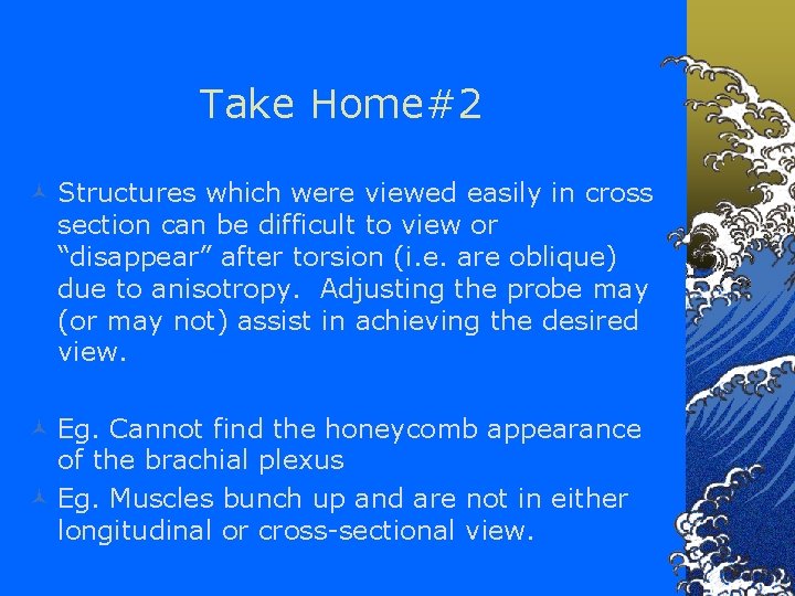 Take Home#2 © Structures which were viewed easily in cross section can be difficult