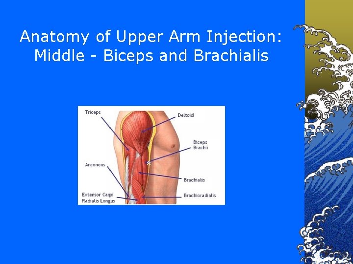 Anatomy of Upper Arm Injection: Middle - Biceps and Brachialis * 