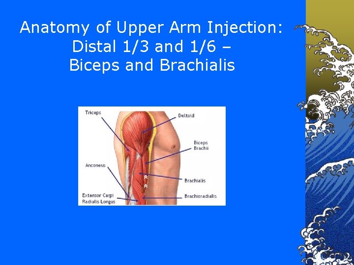 Anatomy of Upper Arm Injection: Distal 1/3 and 1/6 – Biceps and Brachialis *