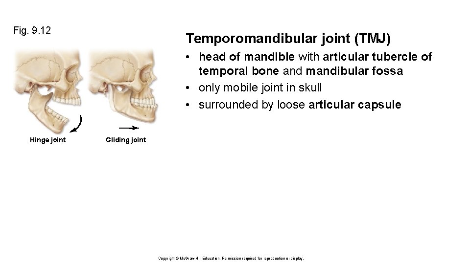 Fig. 9. 12 Temporomandibular joint (TMJ) • head of mandible with articular tubercle of