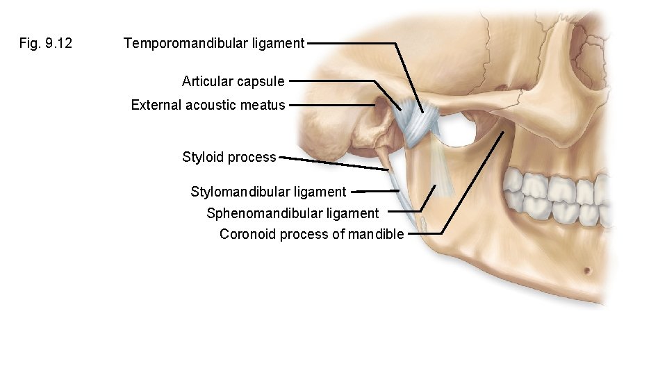 Fig. 9. 12 Temporomandibular ligament Articular capsule External acoustic meatus Styloid process Stylomandibular ligament