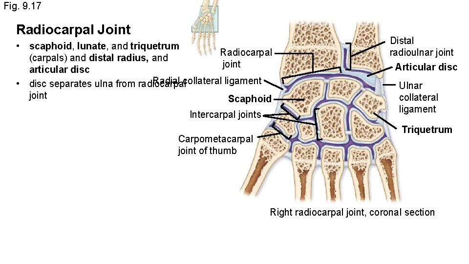 Fig. 9. 17 Radiocarpal Joint • scaphoid, lunate, and triquetrum Radiocarpal (carpals) and distal