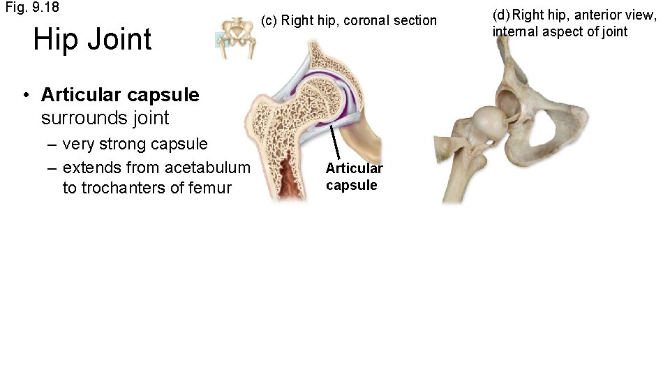 Fig. 9. 18 Hip Joint (c) Right hip, coronal section • Articular capsule surrounds