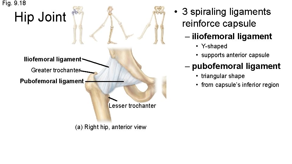 Fig. 9. 18 • 3 spiraling ligaments reinforce capsule Hip Joint – iliofemoral ligament