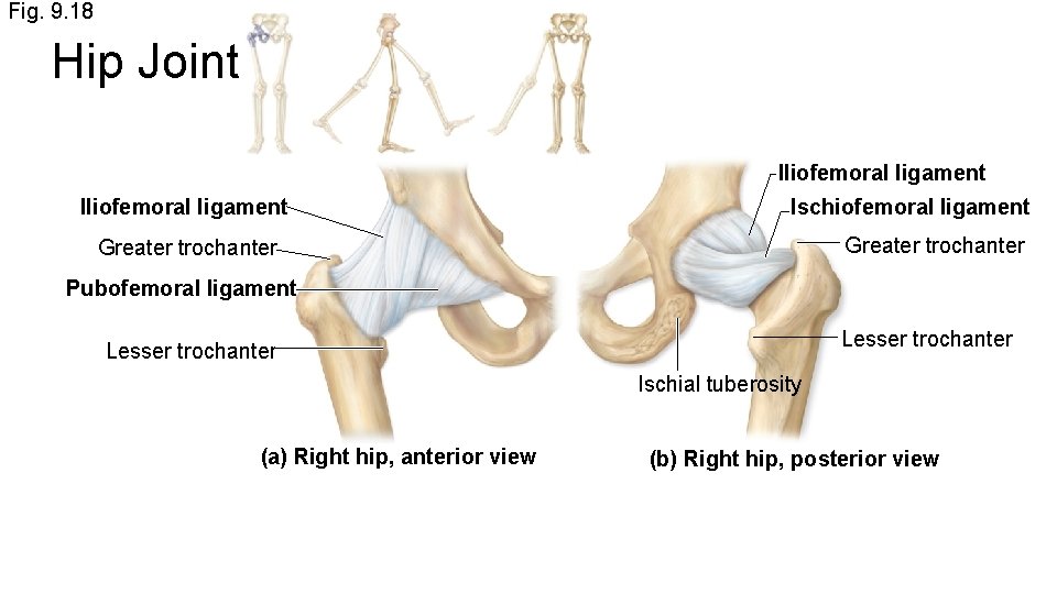 Fig. 9. 18 Hip Joint Iliofemoral ligament Ischiofemoral ligament Greater trochanter Pubofemoral ligament Lesser