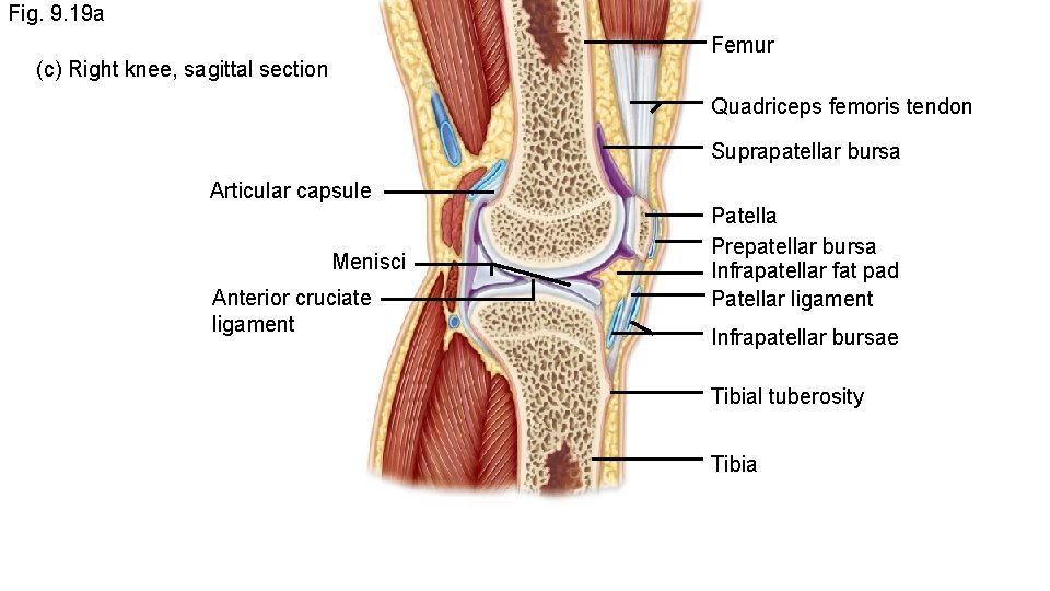 Fig. 9. 19 a Femur (c) Right knee, sagittal section Quadriceps femoris tendon Suprapatellar