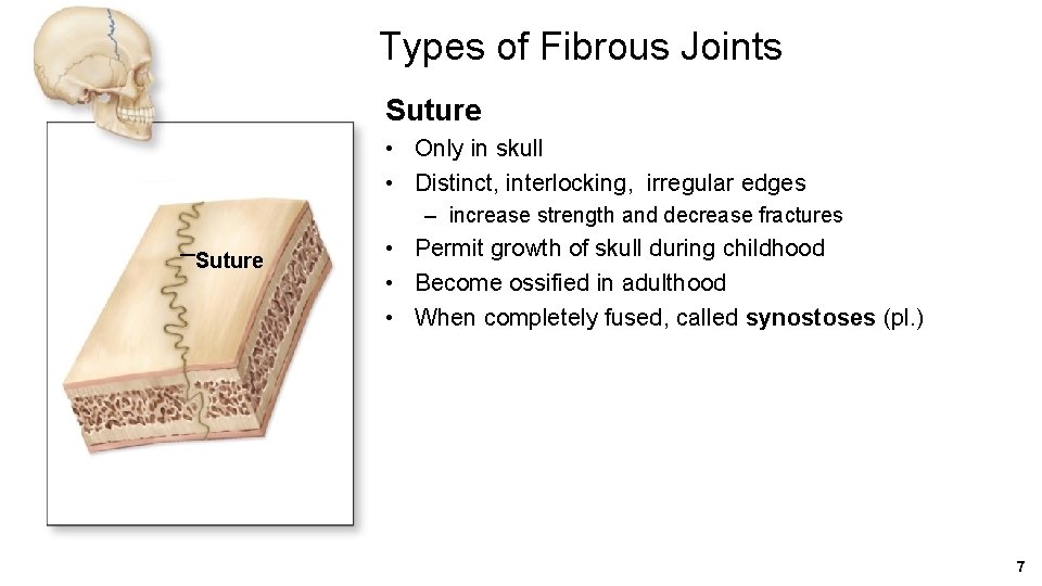 Types of Fibrous Joints Suture • Only in skull • Distinct, interlocking, irregular edges