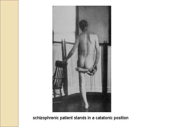 schizophrenic patient stands in a catatonic position 