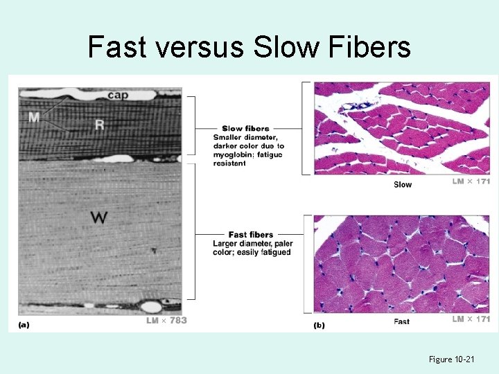 Fast versus Slow Fibers Figure 10– 21 