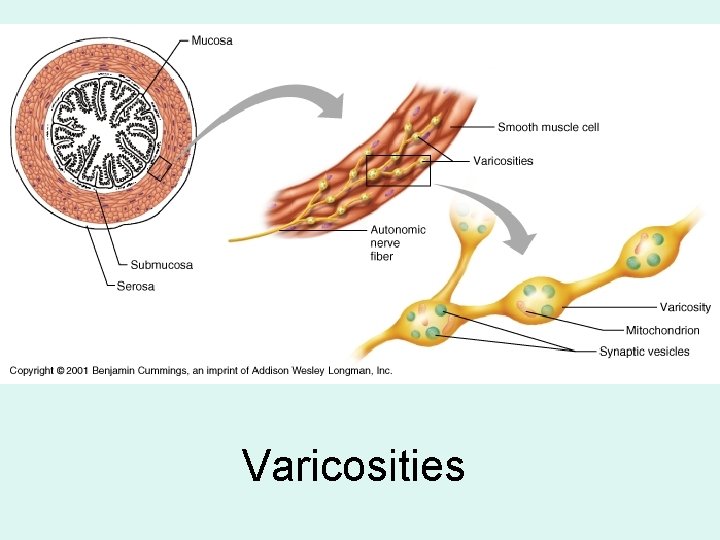 Varicosities 