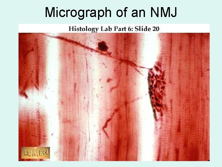 Micrograph of an NMJ 