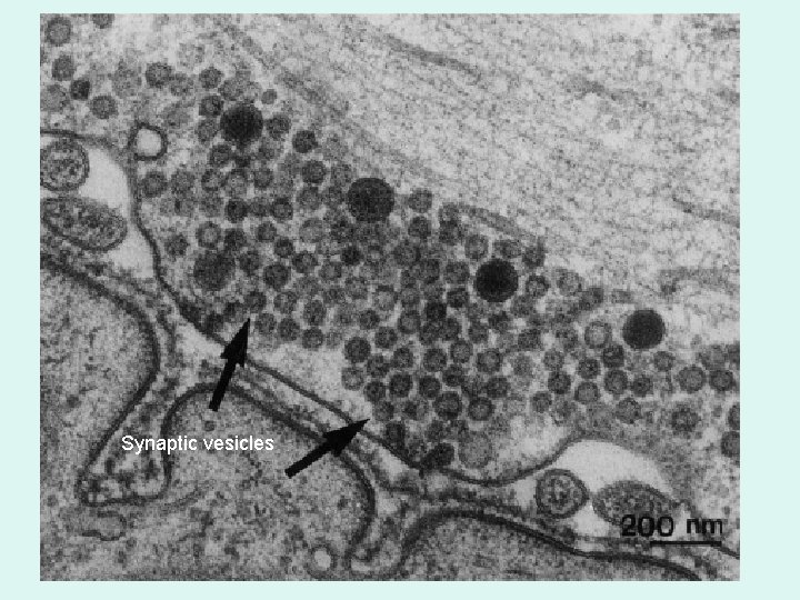A Synapse Synaptic vesicles 