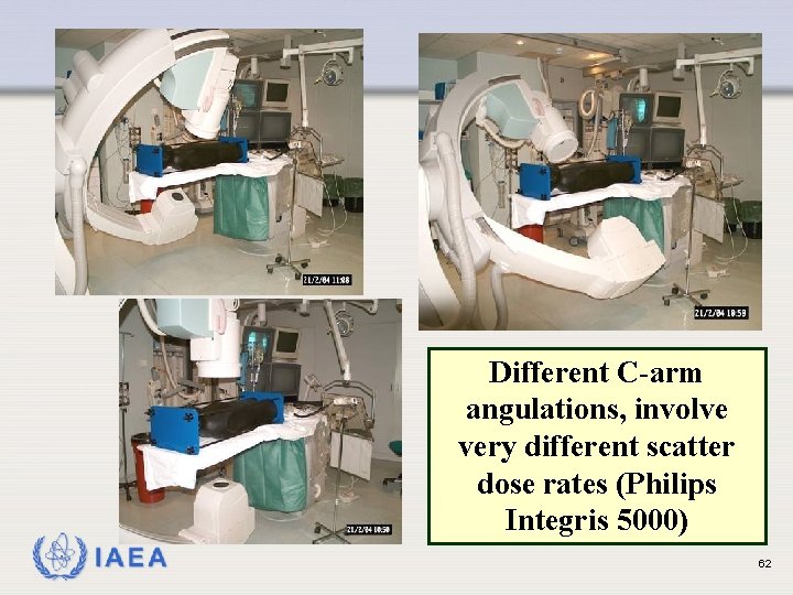 Different C-arm angulations, involve very different scatter dose rates (Philips Integris 5000) IAEA 62
