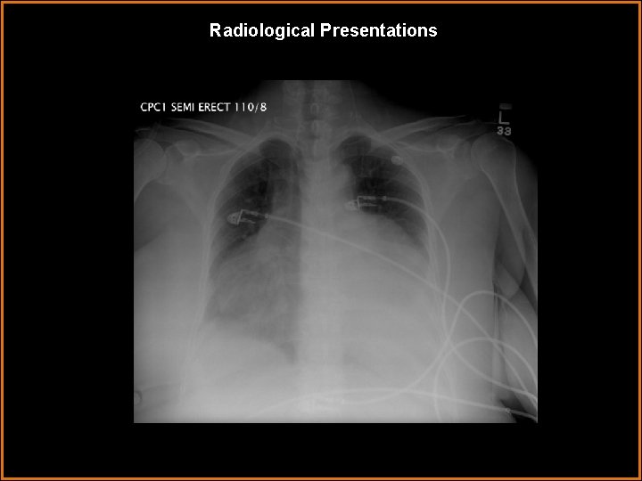 Radiological Presentations 