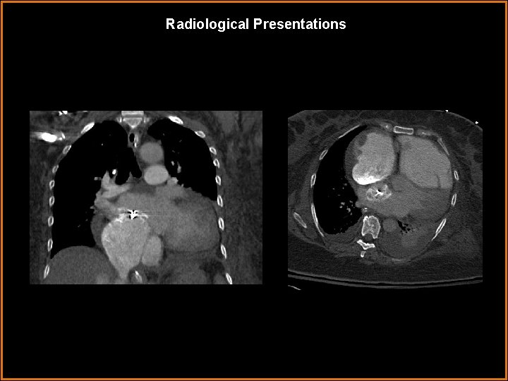 Radiological Presentations 