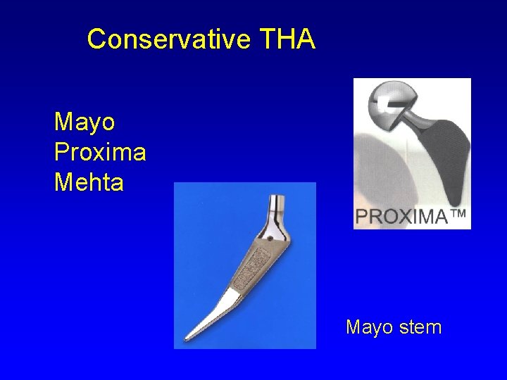 Conservative THA Mayo Proxima Mehta Mayo stem 