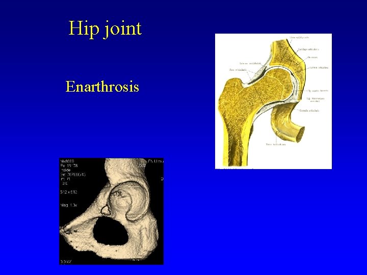 Hip joint Enarthrosis 