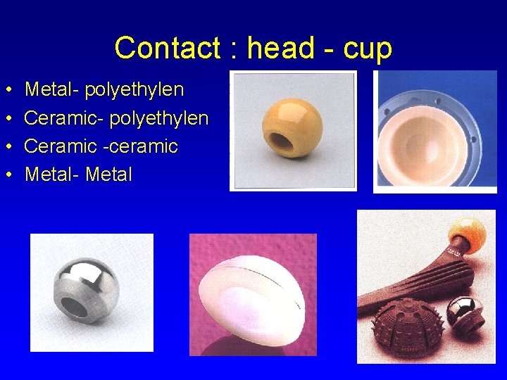 Contact : head - cup • • Metal- polyethylen Ceramic -ceramic Metal- Metal 