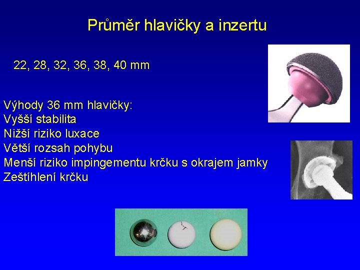 Průměr hlavičky a inzertu 22, 28, 32, 36, 38, 40 mm Výhody 36 mm