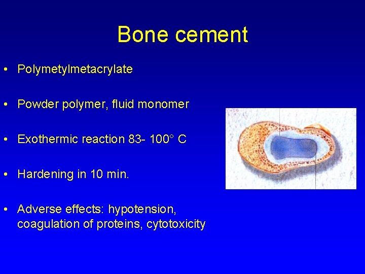 Bone cement • Polymetylmetacrylate • Powder polymer, fluid monomer • Exothermic reaction 83 -