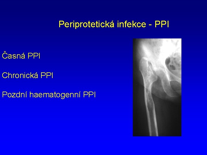 Periprotetická infekce - PPI Časná PPI Chronická PPI Pozdní haematogenní PPI 