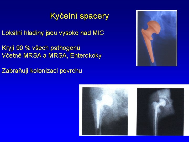 Kyčelní spacery Lokální hladiny jsou vysoko nad MIC Kryjí 90 % všech pathogenů Včetně