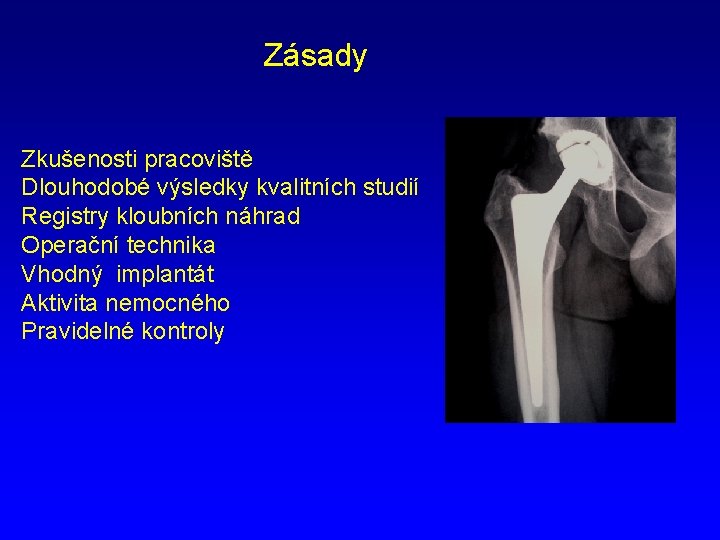 Zásady Zkušenosti pracoviště Dlouhodobé výsledky kvalitních studií Registry kloubních náhrad Operační technika Vhodný implantát