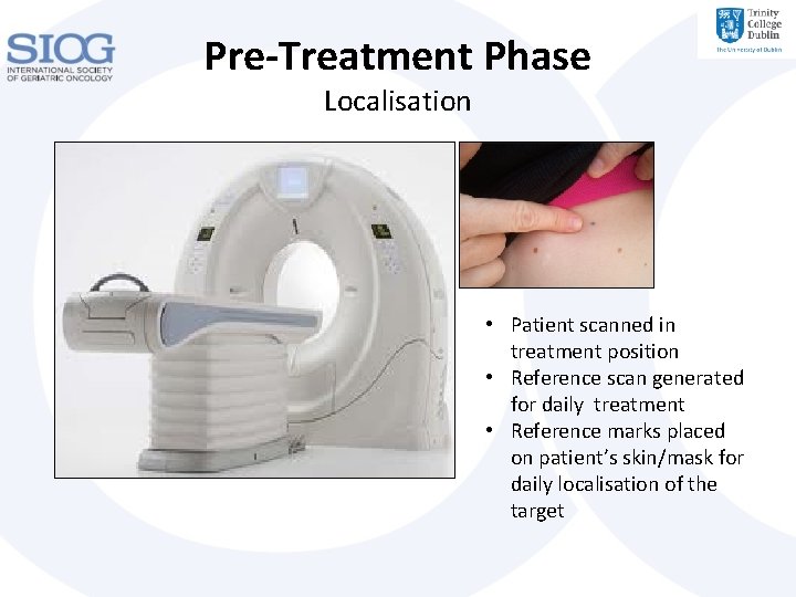 Pre-Treatment Phase Localisation • Patient scanned in treatment position • Reference scan generated for