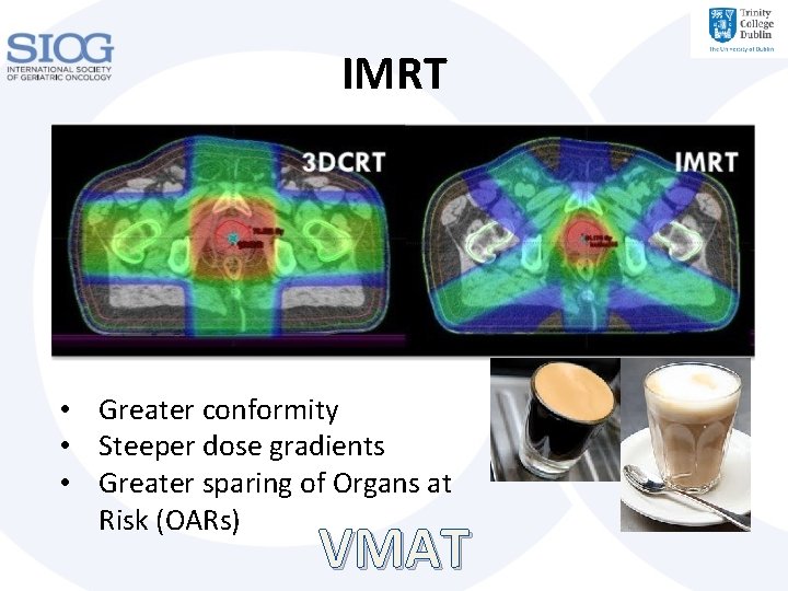 IMRT • Greater conformity • Steeper dose gradients • Greater sparing of Organs at