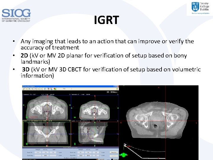 IGRT • Any imaging that leads to an action that can improve or verify