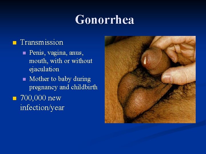 Gonorrhea n Transmission n Penis, vagina, anus, mouth, with or without ejaculation Mother to
