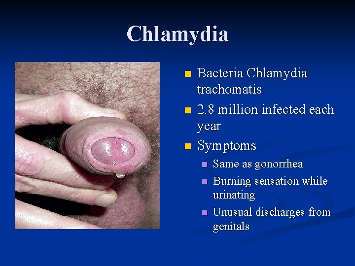 Chlamydia n n n Bacteria Chlamydia trachomatis 2. 8 million infected each year Symptoms