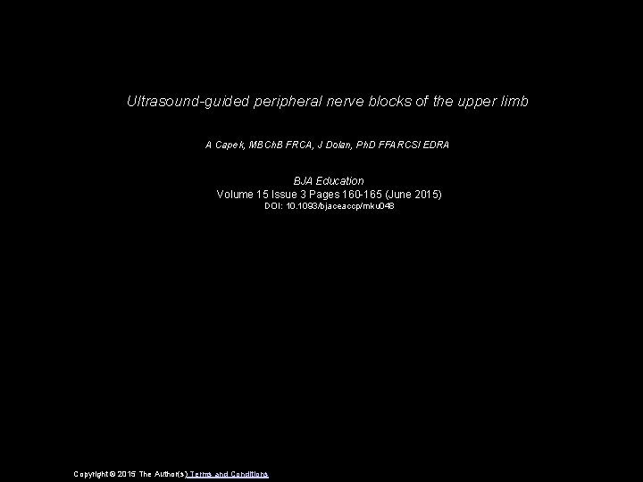 Ultrasound-guided peripheral nerve blocks of the upper limb A Capek, MBCh. B FRCA, J