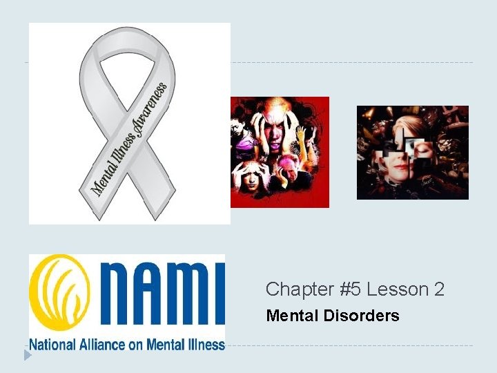 Chapter #5 Lesson 2 Mental Disorders Chapter #5 Lesson 2 Mental Disorders